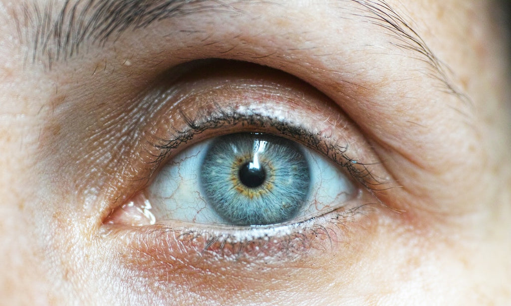 How to treat eczema around your eyes