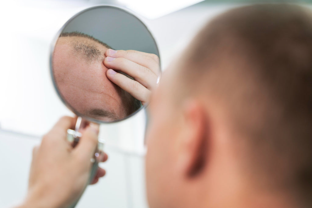 Understanding the Link Between Psoriasis and Hair Loss: Causes, Treatments, and Prevention