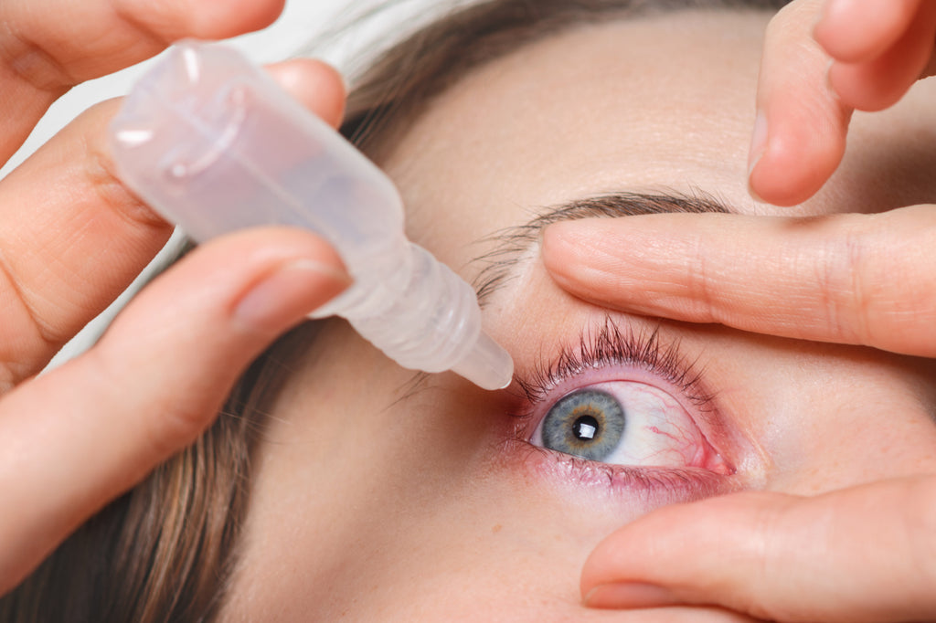 The Ultimate Guide to Effective Blepharitis Treatment Over the Counter