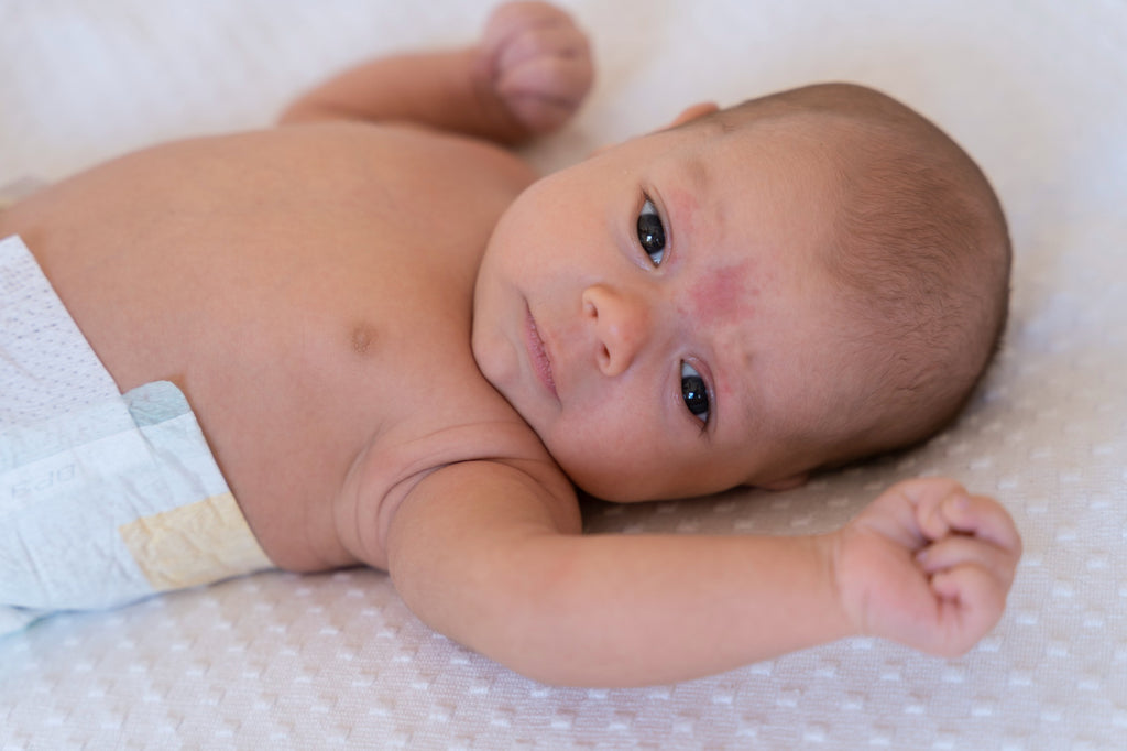 The Essential Guide to Newborn Red Skin: Causes, Symptoms, and Effective Remedies