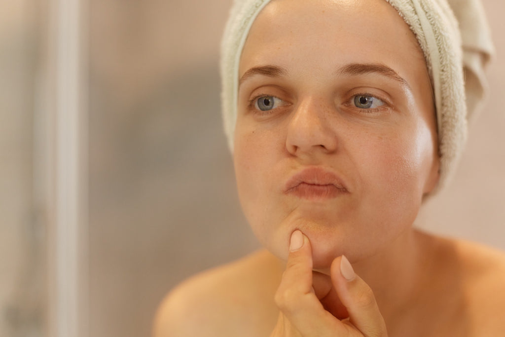 The Ultimate Guide: How to Get Rid of Acne and Finally Stop Picking