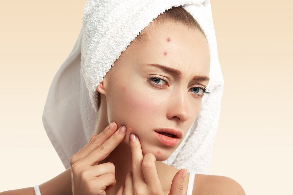Unlocking the Secrets of Spironolactone: How Long Does It Take to Work for Acne Treatment?