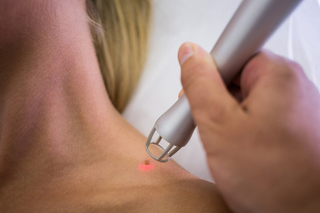 The Ultimate Guide to Psoriasis Laser Treatment: How to Find Relief and Improve Your Skin