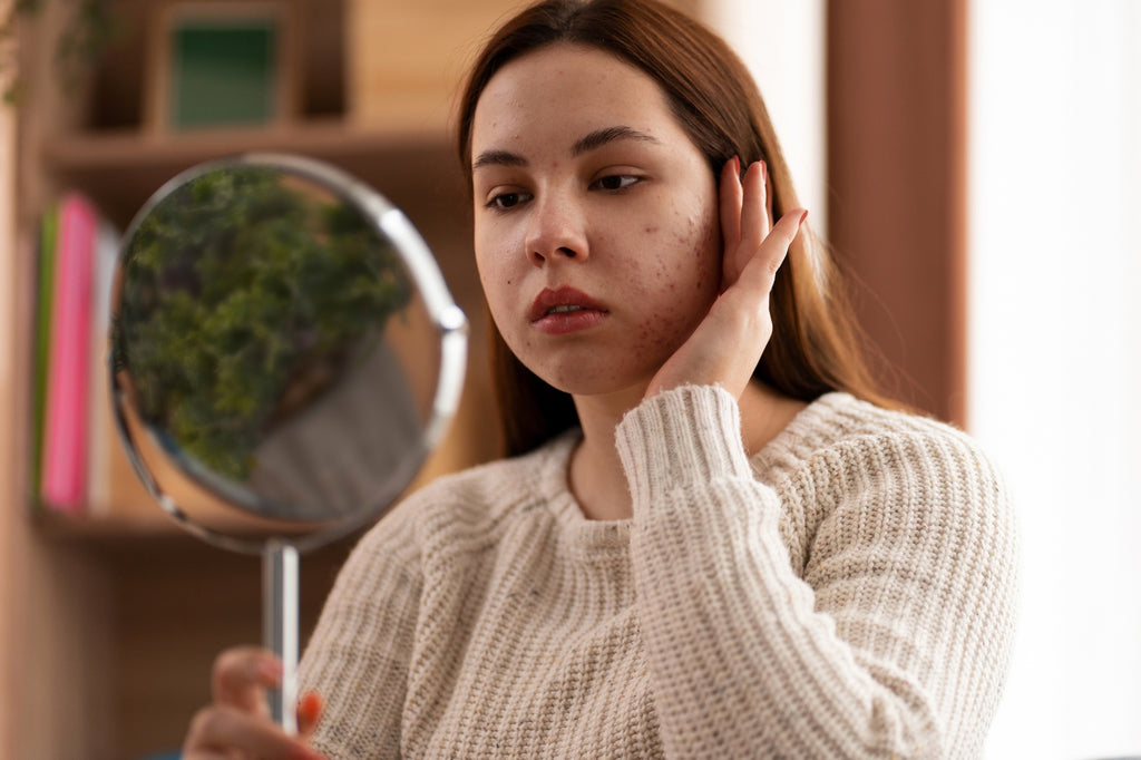 Unveiling the Truth: How to Manage Psoriasis on Your Face with Expert Advice