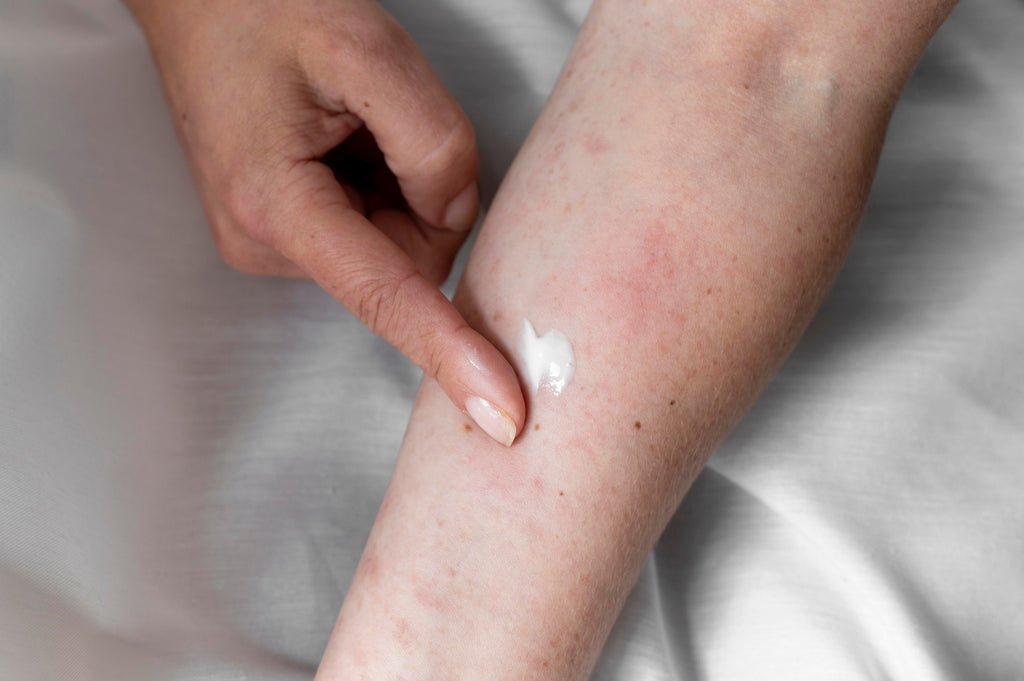 Understanding the Difference: Rash vs. Hives - A Comprehensive Guide