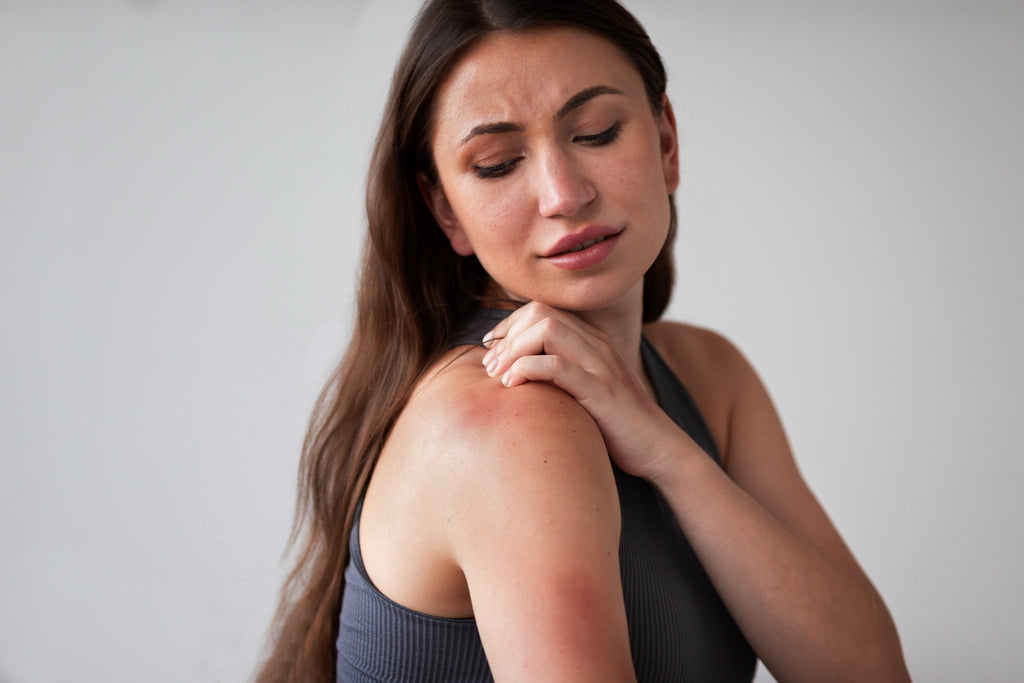 Soothing Solutions: How to Stop Sunburn Itching and Find Relief